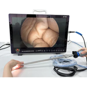 Sy-PS050 Full HD 1080P Rigid Endoscope Camera Endoscope System for Laparoscopy