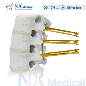 Nx Medical Orthopedic Spinal