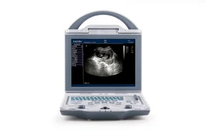 Durable/ Functional/ Affordable B/W Ultrasound Scanner for Human (KX5600)