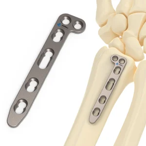 Distal Radius Dorsal Locking L Plate