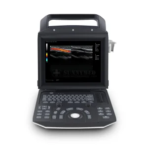 3D 4D Laptop Ultrasound