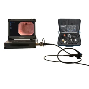 Medical Flexible Endoscopy Camera System for Colonoscopy and Colonoscopy