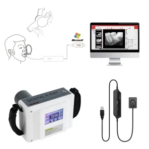 Dental Equipment Digital Portable Dental X Ray Unit and Hdr 500 Digital Dental Sensor Set