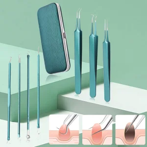 Blackhead Remover Kit