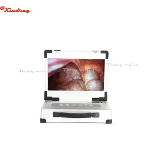 New All-in-One Portable Endoscope Camera System with 17.3 Inches Monitor