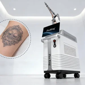 Pico Laser Nd Yag Tattoo Hair Removal