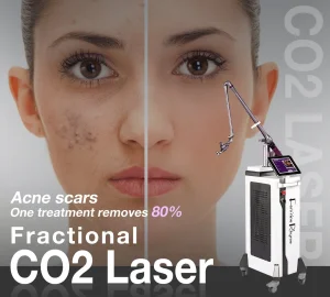 Dermatology Treatment