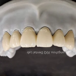 Zirconia Crown