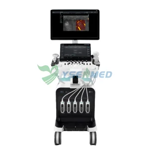 Sistema de Ultrasonido Doppler Color Elite S80 del Hospital Médico