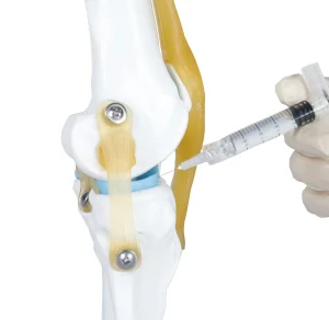 Na Hyaluronate Intra-Articular Device for Orthopedic Surgery Product