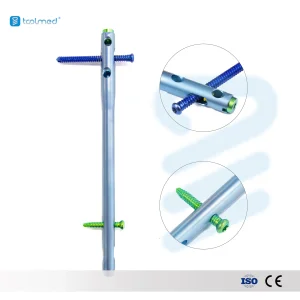 Hindfoot Fusion Ankle Nail Advanced Orthopedic Implant for Interventional Materials Orthopedic Fixation Solution
