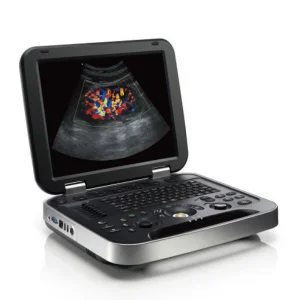 Ultrasound System