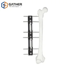 OEM Orthopedic Products Adjustable Knee Fixation Thermoplastic Splints Emergency Splint External Fixator with ISO