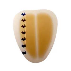 Hydrocolloid Dressing