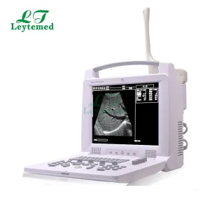 Ltub29 Portable Convex Linear Ultrasound Scanning Diagnostic Ultrasound System