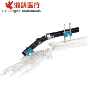 Wrist External Fixator