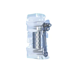 Titanium Fusion Cage