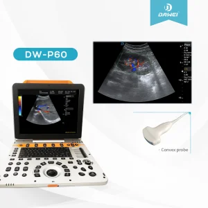15 Sistema de Ultrasonido Portátil de 8 Pulgadas para Cardiología Abdominal Obstetricia Dw-P60