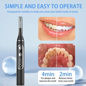 Ultrasonic Teeth Cleaner