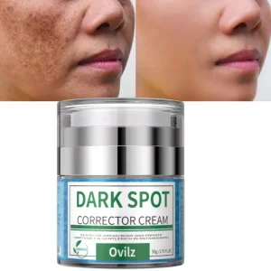 Nicotinamide Dark Spot Corrector