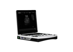 Point of Care Black and White Ultrasound with Battery