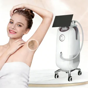 Advanced 808nm Laser Hair Removal System for Home Use