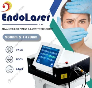 Diode Laser Nail Fungus Treatment