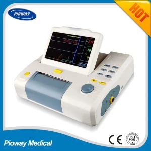Fetal Heartbeat Tracking