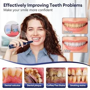 40kHz Ultrasonic Dental Scaler For Home Use Plastic Teeth Cleaner And Plaque Remover For Personal Oral Care And Tooth Whitening