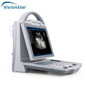 Escáner portátil de ultrasonido inalámbrico para diagnóstico humano con imagenología digital en blanco y negro