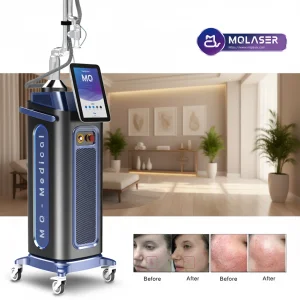 MQ Laser CO2 Laser Bata