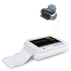 Fetal Monitor