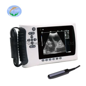Máquina de ultrasonido veterinario portátil digital de mano aprobada de 5 pulgadas para animales como vacas, ovejas, corderos y caballos