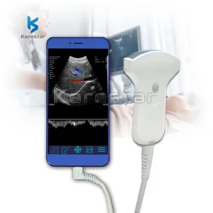 Escáner ultrasónico portátil inalámbrico con Doppler de color, sonda convexa de bolsillo