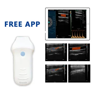 Wireless Ultrasound Scanner
