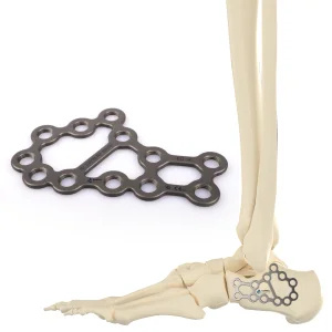 CANWELL Medical Calcaneal Locking Plate Titanium Foot Heel Bone Orthopedic Implants Factory Trauma Fracture Surgery OEM CE ISO