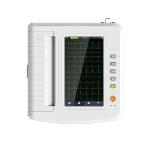 Monitor de ECG Avanzado 12-Channel con Pantalla a Color para Profesionales