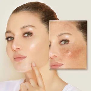 Private Label Vitamin E Whitening Exfoliating Moisturizing Lightening Facial Serum for Face