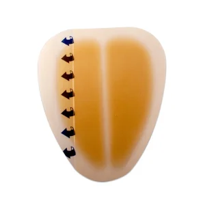 Disposable Advanced Medical Hydrocolloid Wound Dressing