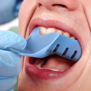 Orthodontic Plastic Tray