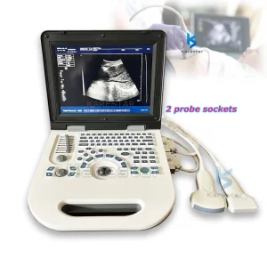Ultrasound Scanner