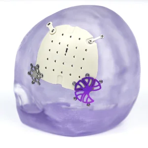 Skull Plate