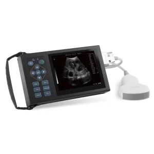 Ultrasonido Portátil Pantalla LED
