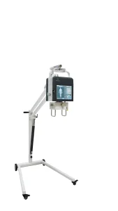 Mobile Digital X-ray Machines