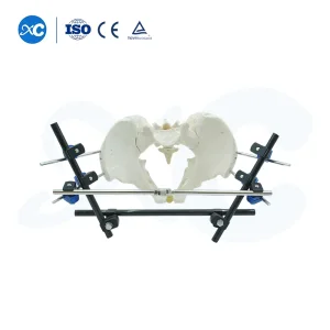 Factory Direct Supply Orthopedic Implant Pin External Fixator - Pelvic &amp; Femoral Fracture Fixation Device Trauma Repair