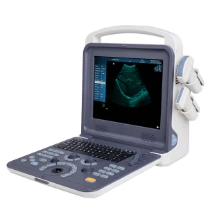 Umy Umus094 Advanced Color Doppler Ultrasonic Diagnostic Imaging System for Professionals