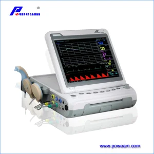 Fetal Monitoring