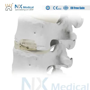 Spine Implant System