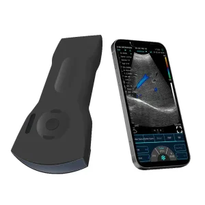 Ultrasound