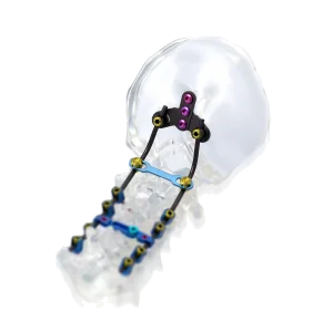 Titanium Spinal Screw System